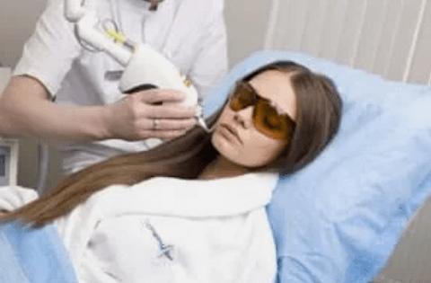 frakcionēta lāzera atjaunošana